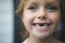 Когда впервые нужно вести ребенка к стоматологу?