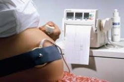 КТГ (кардиотокография) при беременности - когда и как проводится