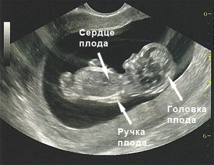 11 неделя беременности: признаки